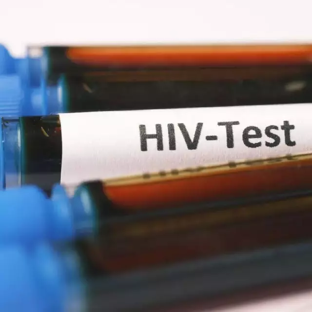 test dépistage vih