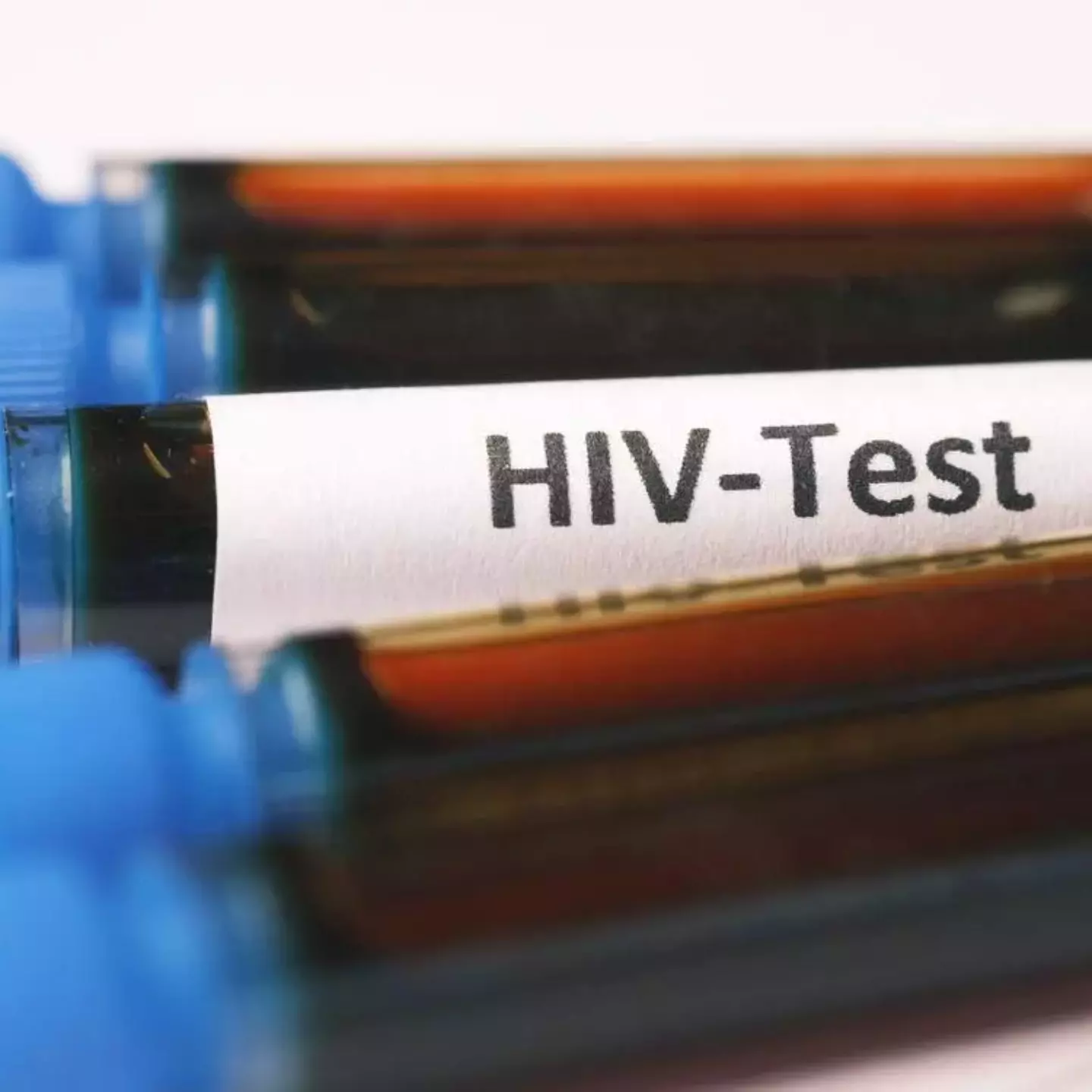 test dépistage vih