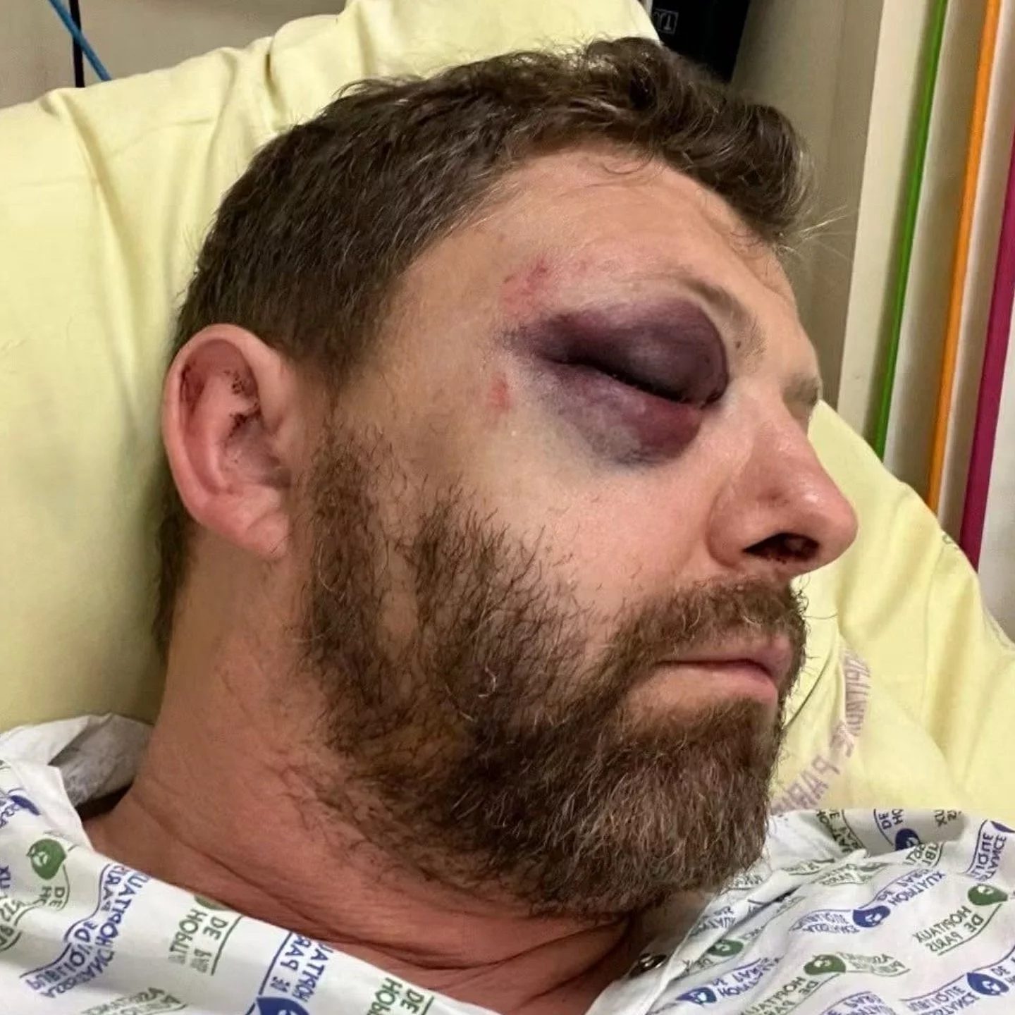 visage de Pierre Picavet rempli de blessures