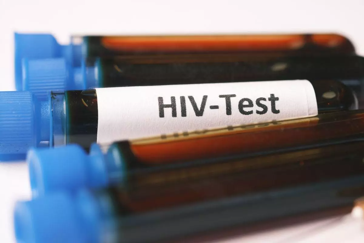 Échantillons sanguins pour un test HIV